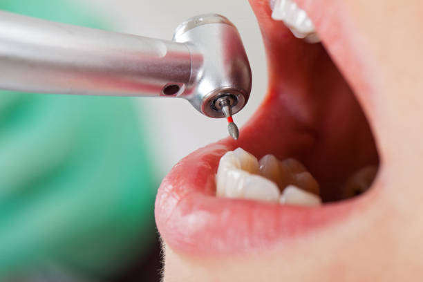 Best Emergency Care for Gum Disease in Golden Gate, FL